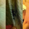 Video: One Couple's Horrifying NYC "Bedbug" Hotel Experience